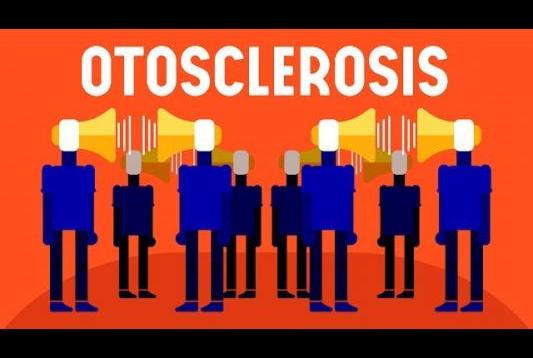 What is Otosclerosis?