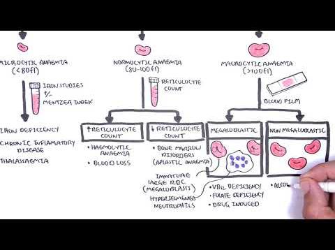 Anaemia (anemia) – classification (microcytic, normocytic and macrocytic) and pathophysiology
