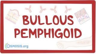 Bullous pemphigoid – causes, symptoms, diagnosis, treatment, pathology