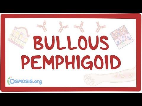 Bullous pemphigoid – causes, symptoms, diagnosis, treatment, pathology