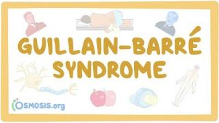 Guillain-Barre Syndrome – causes, symptoms, diagnosis, treatment, pathology