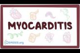 Myocarditis - causes, symptoms, diagnosis, treatment, pathology
