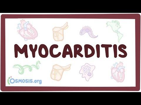 Myocarditis – causes, symptoms, diagnosis, treatment, pathology