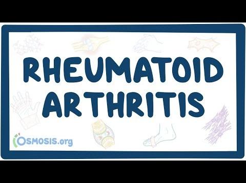 Rheumatoid arthritis – causes, symptoms, diagnosis, treatment, pathology