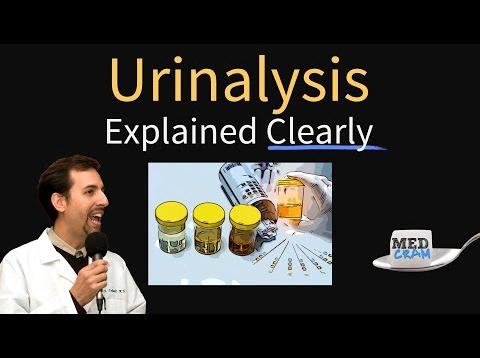 Urinalysis Interpretation Explained Clearly – Glucose & Ketones in Urine