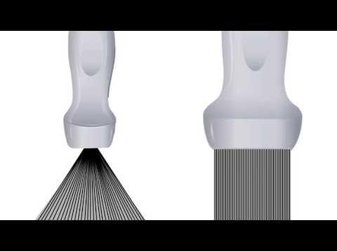 Basic Ultrasound Physics for EM