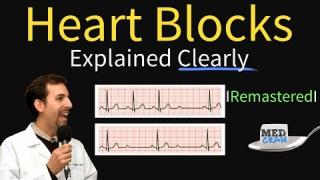 Heart Blocks Explained – First, Second, Third Degree and Bundle Branch on ECG