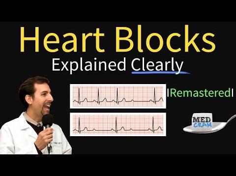 Heart Blocks Explained – First, Second, Third Degree and Bundle Branch on ECG