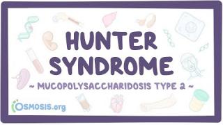Hunter syndrome – causes, symptoms, diagnosis, treatment, pathology