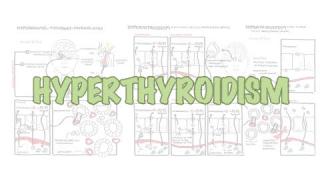 Hyperthyroidism Overview (causes, pathophysiology)