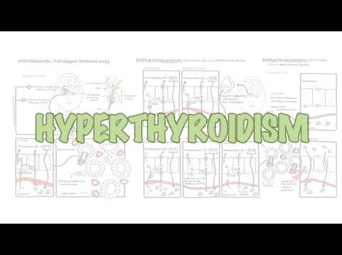 Hyperthyroidism Overview (causes, pathophysiology)