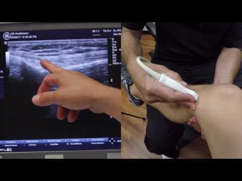 MSK Ultrasound of the Knee w/ Mike Jablon