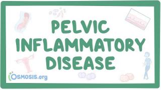Pelvic inflammatory disease – causes, symptoms, diagnosis, treatment, pathology