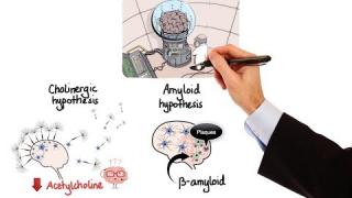 Pharmacology – DRUGS FOR ALZHEIMER’S DISEASE (MADE EASY)