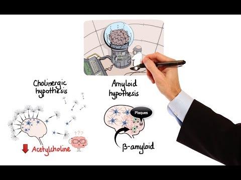 Pharmacology – DRUGS FOR ALZHEIMER’S DISEASE (MADE EASY)