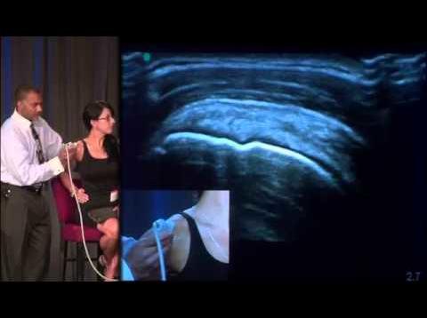 Dr. Don Buford Live 13 Point Shoulder Ultrasound Exam Demo
