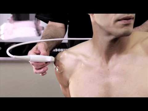 How to Scan the Shoulder with Ultrasound