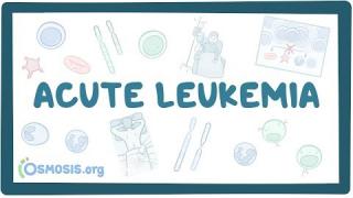 Acute myeloid & lymphoblastic leukemia – causes, symptoms & pathology