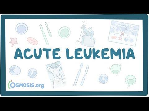 Acute myeloid & lymphoblastic leukemia – causes, symptoms & pathology