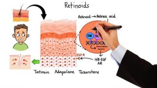 Pharmacology – ACNE TREATMENTS (MADE EASY)