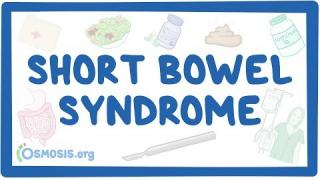 Short bowel syndrome – causes, symptoms, diagnosis, treatment, pathology