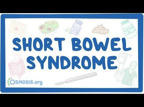 Short bowel syndrome – causes, symptoms, diagnosis, treatment, pathology