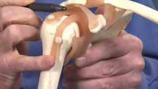 Shoulder Impingement – Dr. Richard Hawkins