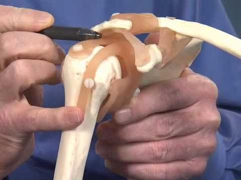 Shoulder Impingement – Dr. Richard Hawkins
