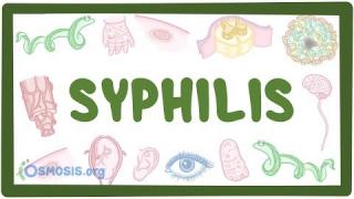 Syphilis – causes, symptoms, diagnosis, treatment, pathology
