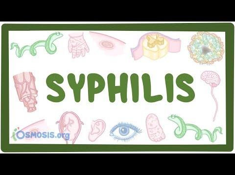 Syphilis – causes, symptoms, diagnosis, treatment, pathology