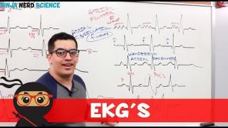 Cardiovascular | EKG’s