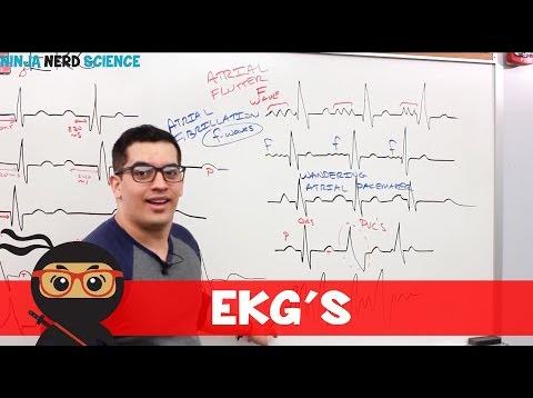 Cardiovascular | EKG’s