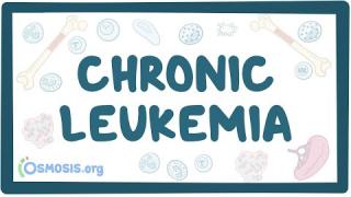 Chronic leukemia – causes, symptoms, diagnosis, treatment, pathology