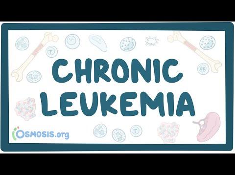 Chronic leukemia – causes, symptoms, diagnosis, treatment, pathology