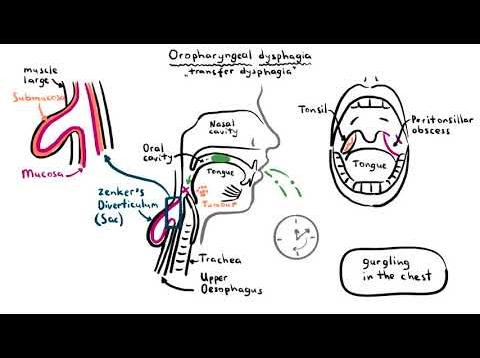 Dysphagia (difficulty swallowing) – causes, pathophysiology, classification, investigation