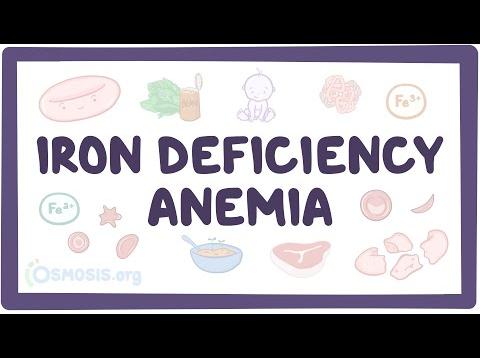 Iron deficiency anemia – causes, symptoms, diagnosis, treatment, pathology
