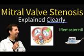 Mitral Valve Stenosis: Diagnosis, Treatment, Pathophysiology