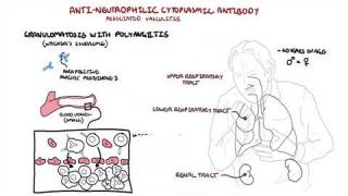 Wegener’s Syndrome – Granulomatosis with Polyangiitis (pathophysiology,  symptoms, treatment)