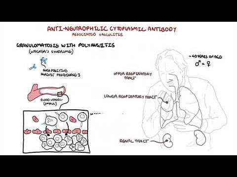 Wegener’s Syndrome – Granulomatosis with Polyangiitis (pathophysiology,  symptoms, treatment)