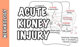 Acute Kidney Injury (AKI) – prerenal, intrarenal and postrenal causes and pathophysiology