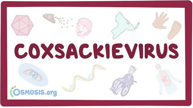 Coxsackievirus – causes, symptoms, diagnosis, treatment, pathology