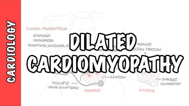 Dilated Cardiomyopathy – causes, symptoms, pathophysiology and treatment