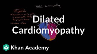 Dilated cardiomyopathy: Pathophysiology and diagnosis | NCLEX-RN | Khan Academy