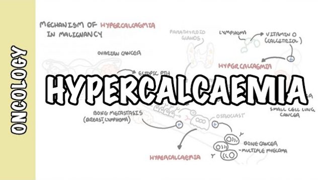 Hypercalcemia in malignancy – causes, pathophysiology, symptoms, treatment