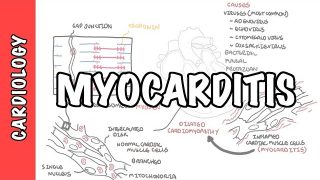 Myocarditis – causes, pathophysiology, investigation and treatment