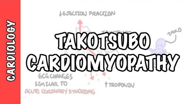 Takotsubo Cardiomyopathy (Broken heart syndrome) – pathophysiology, diagnosis and treatment