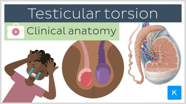 Testicular torsion: causes, symptoms, diagnosis and treatment – Clinical Anatomy | Kenhub
