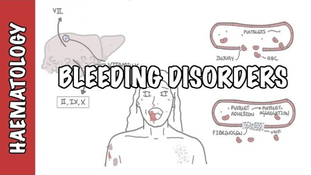 Approach to bleeding disorders – causes, pathophysiology and investigations