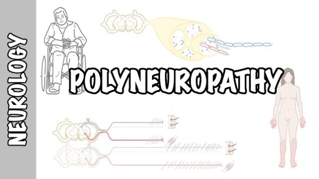 Approach to Polyneuropathy – causes, pathophysiology, investigations