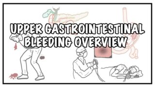 Approach to Upper Gastrointestinal Bleeding – causes, symptoms (melena) and treatment